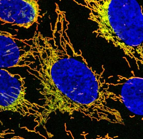 Image of mitochondria (yellow-green) around the cell nucleus (blue). ©Dr Matthew Eramo