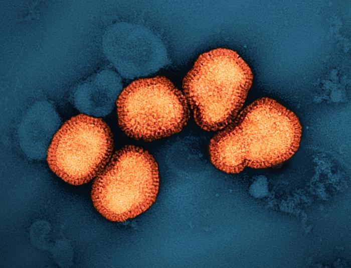 A colorized transmission electron micrograph of influenza A virus particles, colorized orange, isolated from a patient sample and then propagated in cell culture. ©NIAID